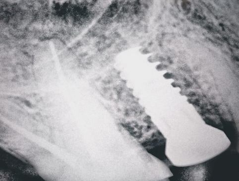 Slider image (2) Smiletec® - Leading Mexicali Dental Clinic